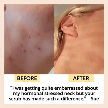 Upcircle - Face Scrub Coffee + Rosehip [Citrus] Vegan, Eco Exfoliator image 2